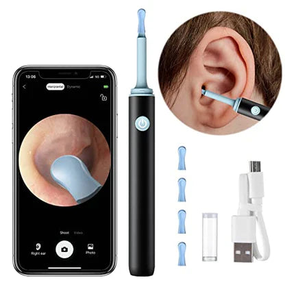VALEN   - PROFESSIONAL EAR WAX REMOVAL TOOL